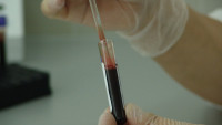 krev1 blood-20745 1280